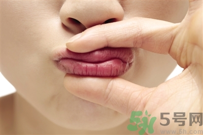 孕婦嘴唇干裂脫皮怎么回事？孕婦嘴唇干裂脫皮是缺什么