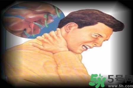 肩頸痛怎么回事？肩頸痛怎么辦？