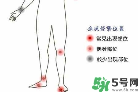 引發(fā)痛風(fēng)的原因是什么？痛風(fēng)病人飲食需注意什么好？