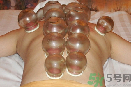 月經(jīng)可以拔火罐嗎？經(jīng)期可以拔火罐嗎？