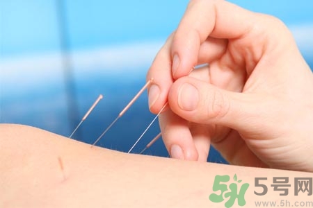 針灸一次要扎多長(zhǎng)時(shí)間？針灸可以幾天做一次？