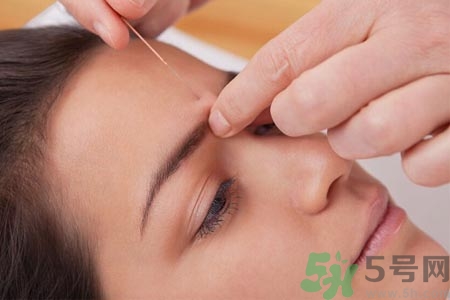 針灸一次要扎多長(zhǎng)時(shí)間？針灸可以幾天做一次？