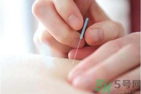 針灸一次要扎多長(zhǎng)時(shí)間？針灸可以幾天做一次？