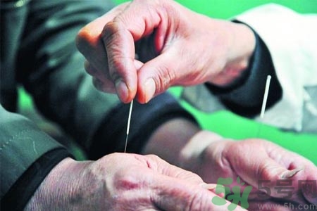 針灸一次要扎多長(zhǎng)時(shí)間？針灸可以幾天做一次？