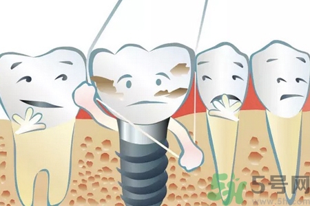 牙線對牙齒好嗎？牙線怎么正確使用？