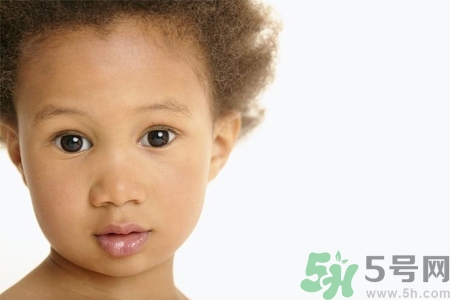 小孩皮膚黑怎么回事？小孩皮膚黑怎么變白？