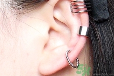 過敏體質(zhì)能打耳洞嗎？疤痕體質(zhì)可以穿耳洞嗎？