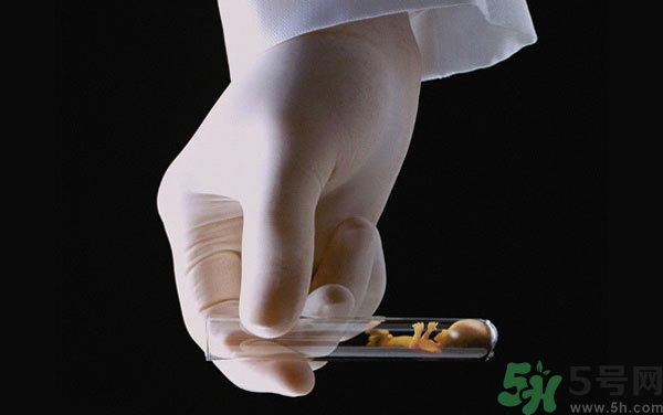 做試管嬰兒要多長時間？做試管嬰兒可以選擇性別？