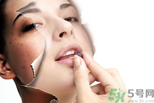 色斑分為哪幾種？有色斑該多吃什么好？