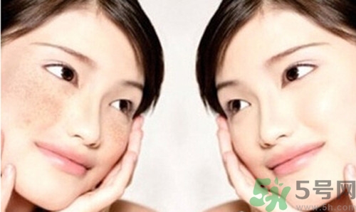 色斑分為哪幾種？有色斑該多吃什么好？