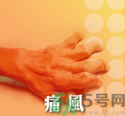 骨關(guān)節(jié)炎能治好嗎？骨關(guān)節(jié)炎平時(shí)注意事項(xiàng)