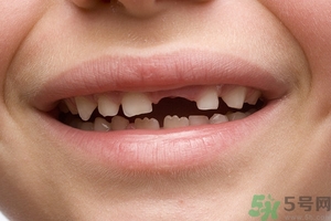 牙齒橫著長怎么辦？智齒橫著長一定要拔嗎？