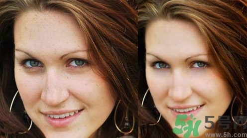 色斑會自己消失嗎？色斑遺傳嗎？