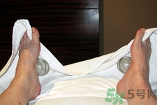 腳底可以拔罐嗎？腳底拔火罐有什么好處？