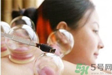 肩膀酸痛可以拔火罐嗎？孕婦肩膀酸痛能拔火罐嗎？