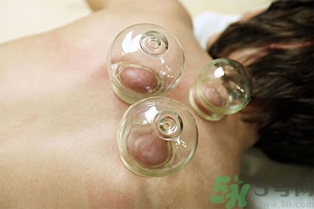 肩膀酸痛可以拔火罐嗎？孕婦肩膀酸痛能拔火罐嗎？