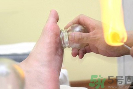 腳底拔罐能去濕氣嗎？腳底拔罐出現(xiàn)青紫正常嗎？