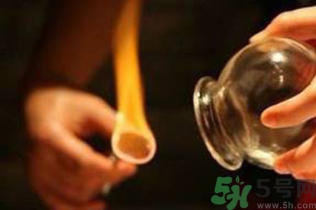 老人能在家拔火罐嗎？老年人拔火罐需要注意什么？