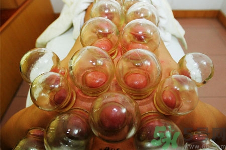 老人能在家拔火罐嗎？老年人拔火罐需要注意什么？