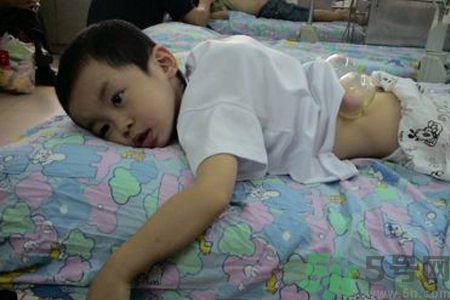 小孩可以拔罐嗎？寶寶能拔火罐嗎？