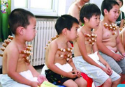 小孩可以拔罐嗎？寶寶能拔火罐嗎？
