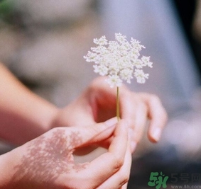 手指被門夾了有淤血怎么辦？手指被門夾了有淤血怎么處理？