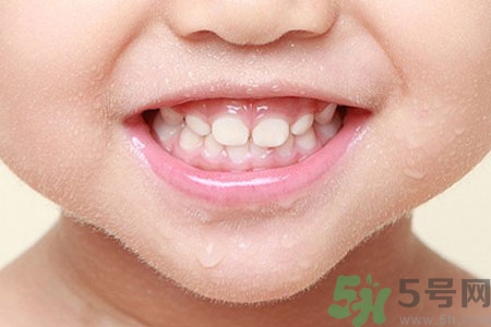 小孩牙齒發(fā)黑怎么回事？小孩牙齒發(fā)黑怎么辦？