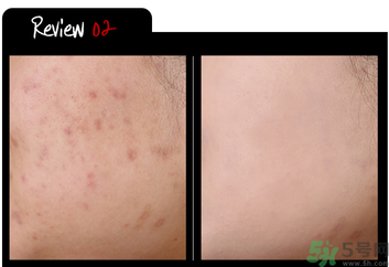 w.lab雪花氣墊黑色款怎么樣？w.lab雪花氣墊黑色和白色區(qū)別？