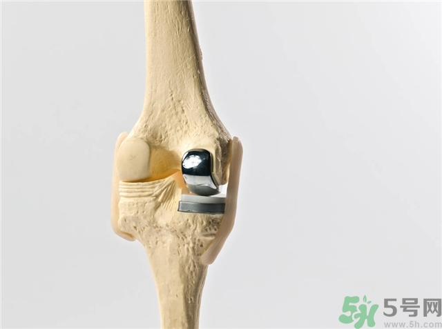 膝關(guān)節(jié)疼痛是怎么回事該怎么辦？膝關(guān)節(jié)疼痛如何治療？