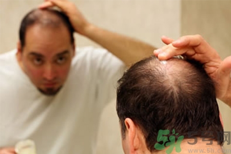掉頭發(fā)需要檢查什么？脫發(fā)需要做什么檢查？