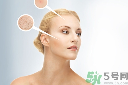 甘油會(huì)堵塞毛孔嗎？甘油堵塞毛孔怎么辦？