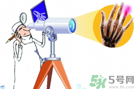 什么年齡測(cè)骨齡最好？如何測(cè)骨齡？