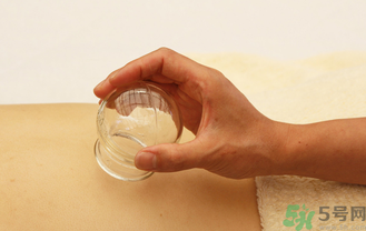 秋天可以拔火罐嗎？秋天拔火罐好嗎？