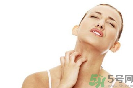 臉過敏發(fā)紅癢怎么辦？臉過敏發(fā)紅癢擦什么藥好？