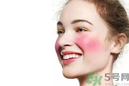 臉過敏發(fā)紅癢怎么辦？臉過敏發(fā)紅癢擦什么藥好？