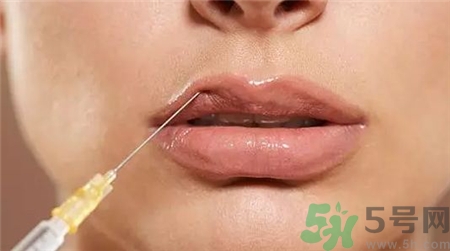 玻尿酸豐唇后多久消腫?玻尿酸豐唇后多久變軟? 玻尿酸豐唇后多久消腫?玻尿酸豐唇后多久變軟?