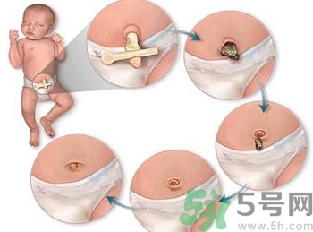 新生兒肚臍可以碰水嗎？新生兒肚臍沒脫落能洗澡嗎？