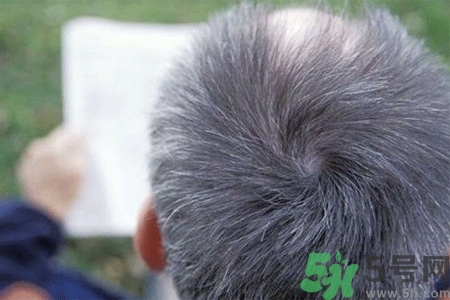 缺什么頭發(fā)會(huì)變白？年輕人頭發(fā)變白是缺維生素嗎？