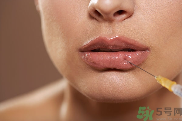 打膠原蛋白好還是玻尿酸好,玻尿酸和膠原蛋白的區(qū)別 打膠原蛋白好還是玻尿酸好,玻尿酸和膠原蛋白的區(qū)別