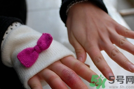 冬天長(zhǎng)凍瘡怎么辦？冬天手上長(zhǎng)凍瘡怎么辦？