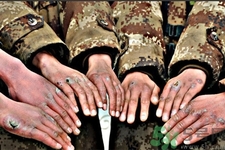 怎樣提前預(yù)防凍瘡比較有效？冬天預(yù)防凍瘡的小妙招