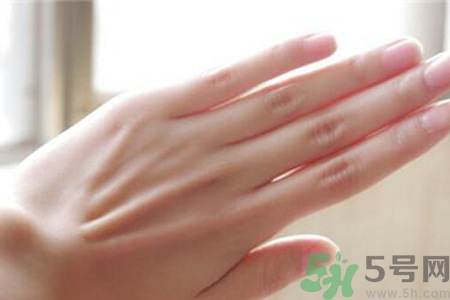 患凍瘡是身體缺什么嗎？長(zhǎng)凍瘡是身體缺維生素嗎？