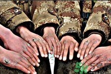 凍瘡為什么會(huì)癢？凍瘡發(fā)癢能用鹽水泡嗎？