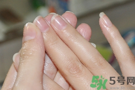 ?指甲上有豎紋是缺什么？指甲上有豎紋是缺維生素嗎？