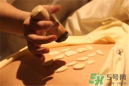 冬季艾灸有什么好處嗎？冬天艾灸需要注意什么？