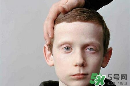 青少年面癱是怎么回事？青少年面癱是怎么辦？