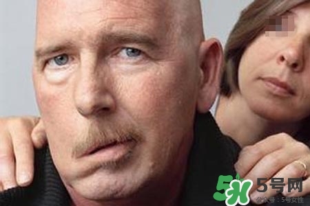 老年人為什么容易得面癱？老年人面癱原因有哪些？