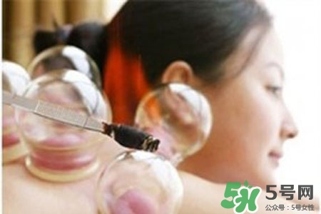 拔罐放血對身體好嗎？拔罐放血有什么好處？