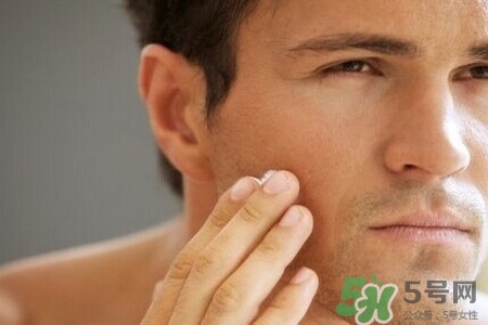 男人臉上酒刺怎么去掉？臉上長酒刺是怎么回事？