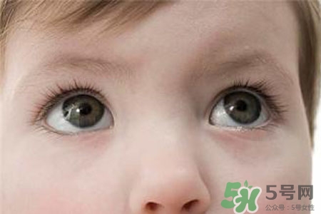 眼睛哭腫了怎么辦？眼睛哭腫了如何快速消腫？